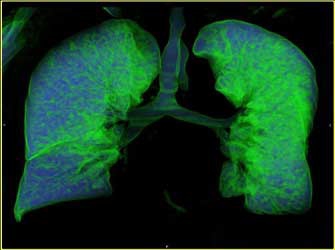 Δωρεάν πνευμονολογική εξέταση στους επιβάτες της Olympic Air