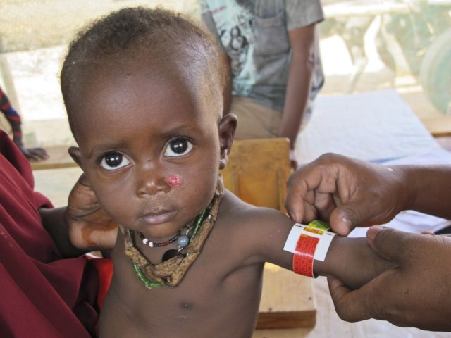 Συγκλονιστικές οι μαρτυρίες των Γιατρών Χωρίς Σύνορα για την κατάσταση στη Σομαλία