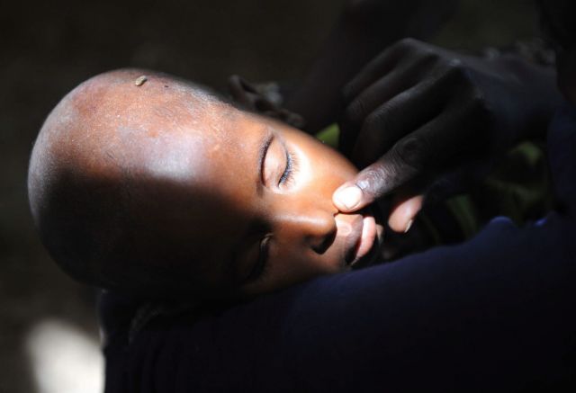 Εκατομμύρια παιδιά κινδυνεύουν με σωματική και πνευματική καθυστέρηση λόγω υποσιτισμού