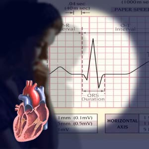 Διαφορετική η συμπτωματολογία του εμφράγματος στις γυναίκες