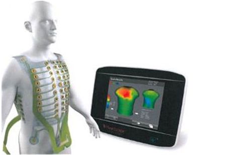Έξυπνο γιλέκο παρακολουθεί την καρδιά σε 3D, προειδοποιεί για έμφραγμα