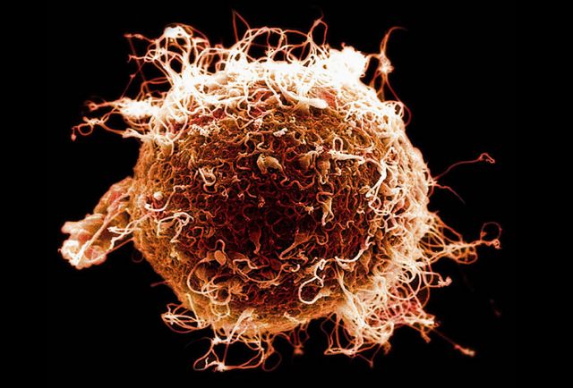 Βλαστοκύτταρα που ανακαλύφθηκαν στις γυναίκες «θα γίνουν αστείρευτη πηγή ωαρίων»