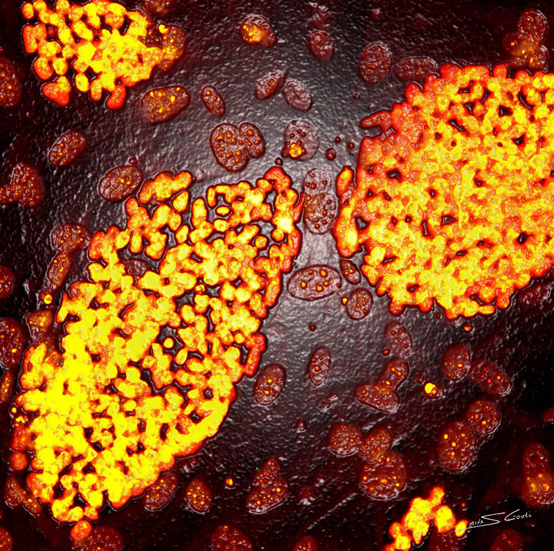 «Μάρτιος 2012: Μήνας Ενημέρωσης για τις Νευροεπιστήμες»