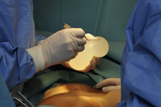 Διευρύνεται ο αριθμός των γυναικών με τα επικίνδυνα εμφυτεύματα στη Βρετανία