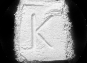 Η κατάχρηση κεταμίνης προκαλεί ακράτεια ούρων και κοιλιακά άλγη