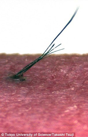 Βλαστοκύτταρα χαρίζουν μαλλιά σε φαλακρά πειραματόζωα