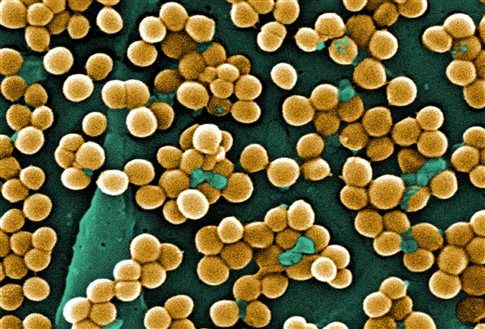 Η αχίλλειος πτέρνα του διαβόητου «υπερβακτηρίου» MRSA