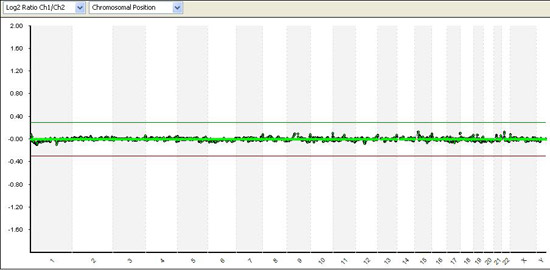 Γενετικό τεστ ανιχνεύει με βεβαιότητα ανωμαλίες και σύνδρομα στο έμβρυο