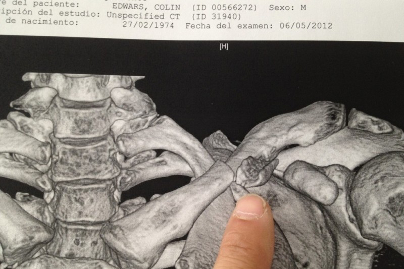 MotoGP 2012: Εκτός Le Mans ο C. Edwards