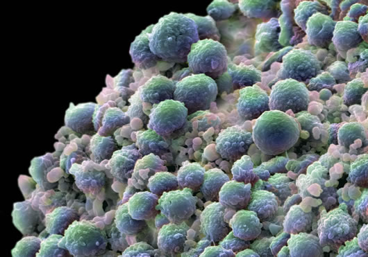 Μείωση των παρενεργειών της χημειοθεραπείας με βλαστοκύτταρα