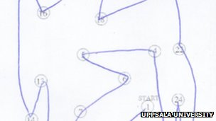 Τεστ ζωγραφικής προβλέπει τον κίνδυνο θανάτου από εγκεφαλικό επεισόδιο