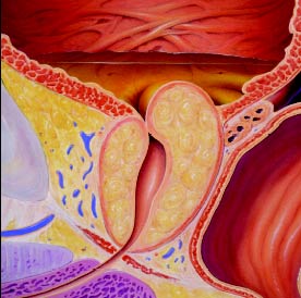 Πανελλαδική Εκστρατεία Ενημέρωσης για την Καλοήθη Υπερπλασία του Προστάτη