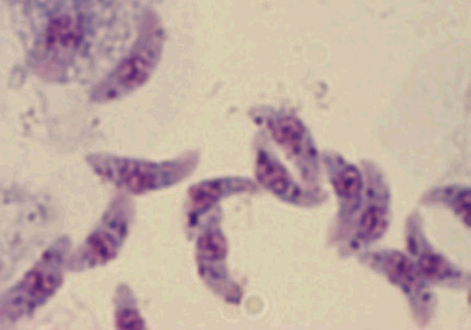 Το τοξόπλασμα ενδεχομένως να προδιαθέτει σε αυτοκτονία