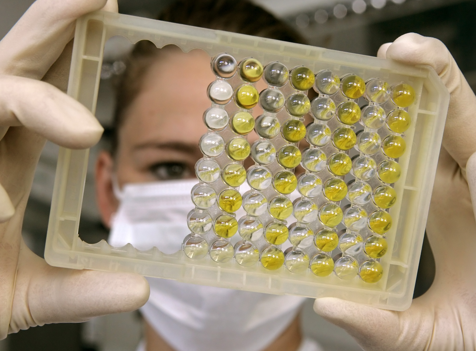 Νέα κατεύθυνση στην αντικαρκινική θεραπεία ίσως δώσει η ανακάλυψη μεταλλαγμένης μορφής γονιδίου