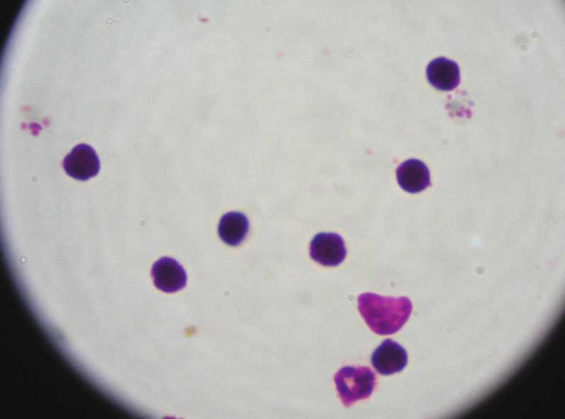 Αποκωδικοποιήθηκε το DNA παρασίτου που προκαλεί ελονοσία