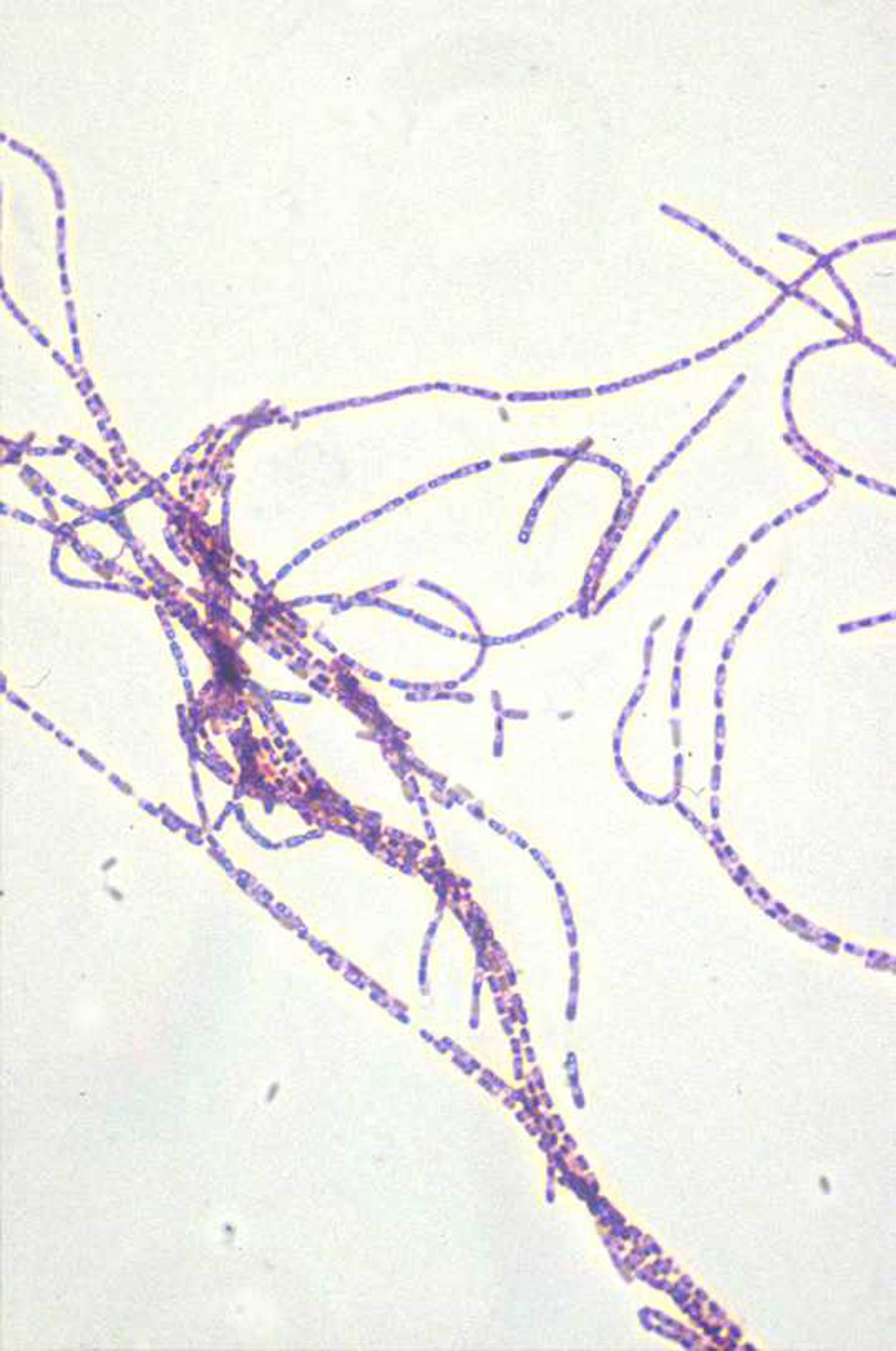 Ένας ακόμη θάνατος χρήστη ναρκωτικών από το βακτήριο του άνθρακα στη Βρετανία