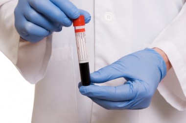 Εβδομάδα Δωρεάν Προληπτικού Ελέγχου για τον Καρκίνο του Προστάτη