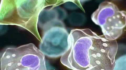 Η τοσιλιζουμάμπη προσφέρει καλύτερη ποιότητα ζωής σε ασθενείς με ρευματοειδή αρθρίτιδα