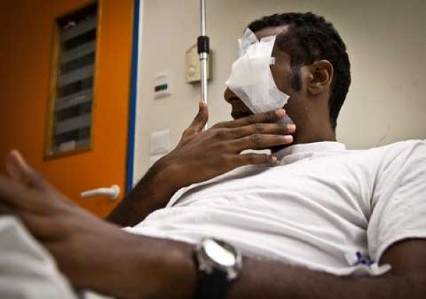 Μερική τύφλωση Ελληνο-αιγύπτιου από ρατσιστική επίθεση