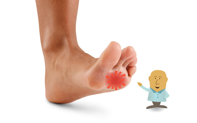 Υποφέρετε από Μεταταρσαλγία; Αντιμετωπίστε την χωρίς χειρουργείο