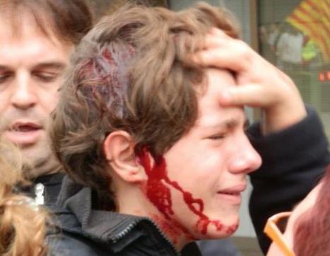 «Βράζει» η Ισπανία, 13χρονος τραυματίας από αστυνομική βία