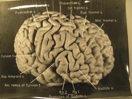 Ξεχασμένες φωτογραφίες αποκαλύπτουν ιδιαιτερότητες στον εγκέφαλο του Άινσταϊν
