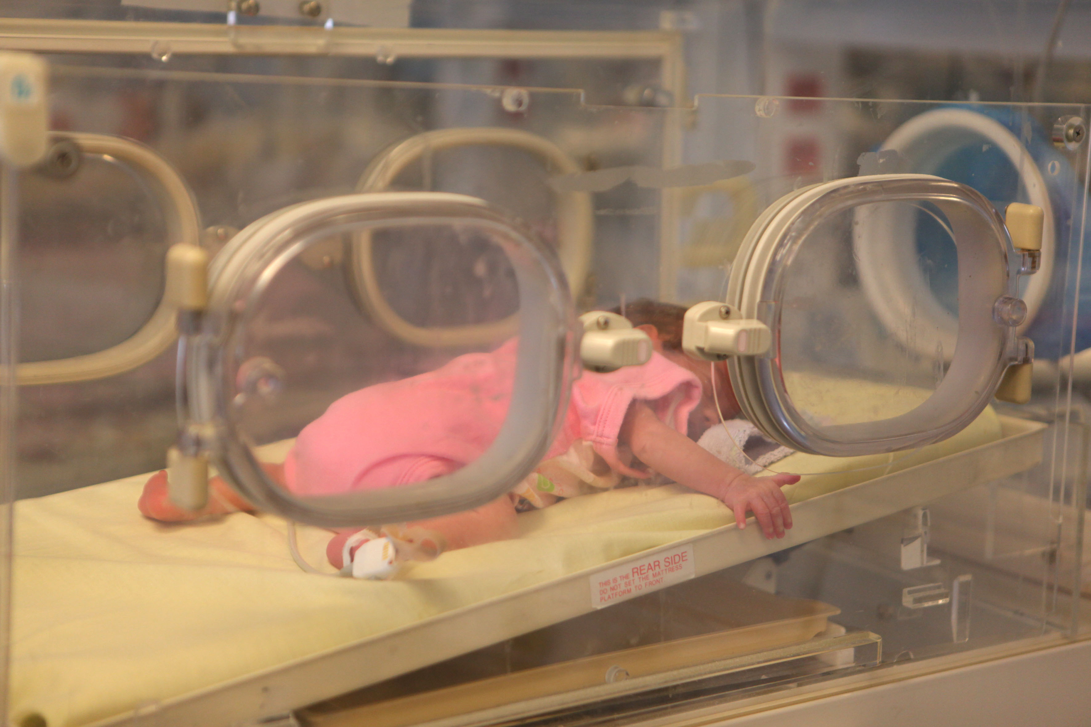 Απουσία πολιτικής υγείας για τα πρόωρα νεογνά στην Ελλάδα