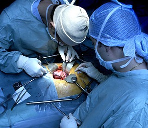 Ουραγός η Ελλάδα στις μεταμοσχεύσεις, παρά την μικρή πρόοδο στους δότες νεφρού