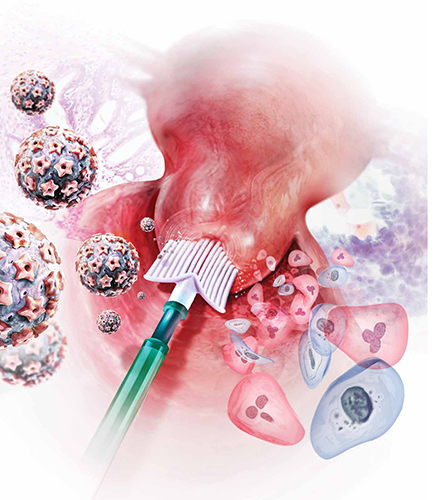 Ως τεστ πρωτοβάθμιου προσυμπτωματικού ελέγχου μπορεί να γίνεται το cobas® 4800 HPV Τest