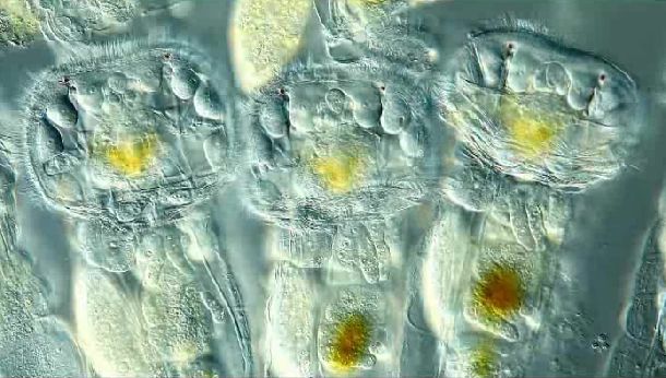 Δέκα βραβευμένες εικόνες από διεθνή διαγωνισμό μικροσκοπίας