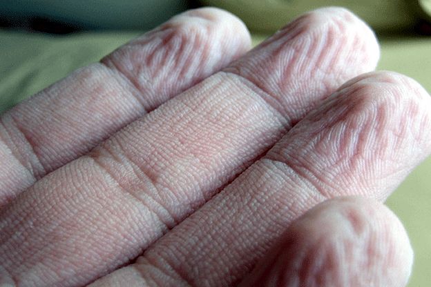 Γιατί τα ανθρώπινα δάχτυλα ζαρώνουν στο νερό