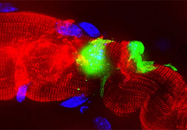 Η λέπρα βρέθηκε να μετατρέπει ώριμα κύτταρα σε βλαστοκύτταρα