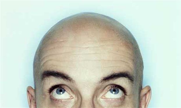 «Αυξημένος κίνδυνος καρκίνου του προστάτη» για τους φαλακρούς