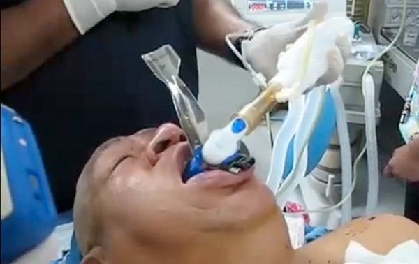 «Αποκλειστική», αλλά ψεύτικη, φωτό του διασωληνωμένου Τσάβες απέσυρε η Εl Paίs