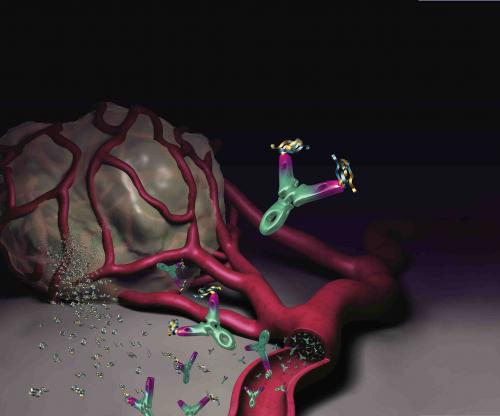 Η μπεβασιζουμάμπη αυξάνει την επιβίωση των ασθενών με γλοιοβλάστωμα