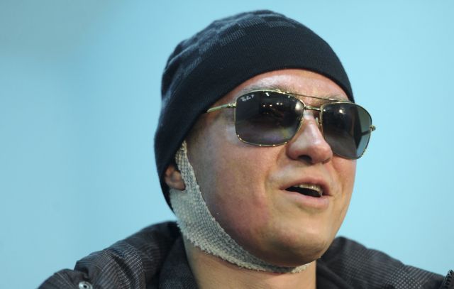 Ξέρω ποιος μου επιτέθηκε, λέει ο καλλιτεχνικός διευθυντής των Μπολσόι