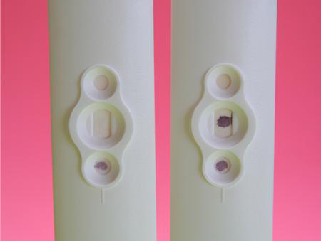 Η εξωσωματική στο μικροσκόπιο