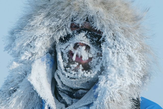 Νευρολογική παρέμβαση καταργεί το αίσθημα του κρύου