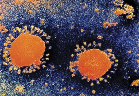 Έκτος θάνατος από νέο ιό στην οικογένεια του SARS
