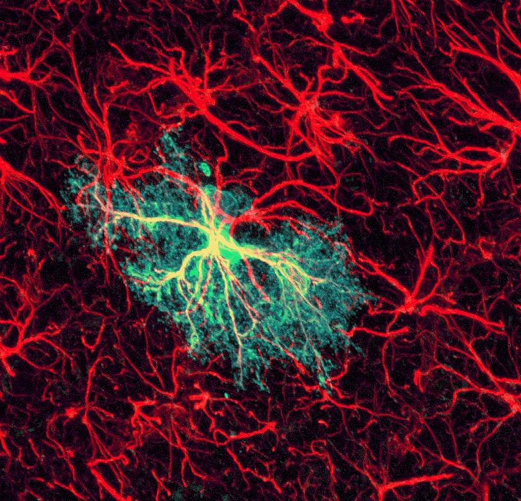 Εγκεφαλικά κύτταρα βελτιώνουν την ευφυΐα πειραματόζωων