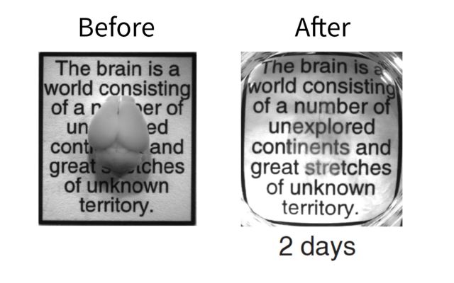 Χημική επεξεργασία κάνει τον εγκέφαλο κυριολεκτικά διάφανο