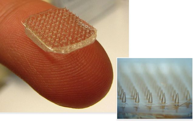 Παρασιτικό σκουλήκι προσφέρει έμπνευση για νέο χειρουργικό τσιρότο