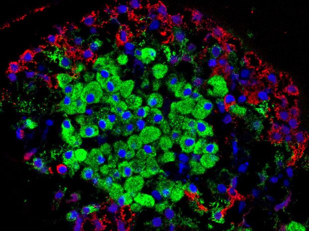 Άγνωστη ως σήμερα ορμόνη υποψήφιο όπλο κατά του διαβήτη