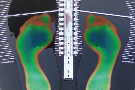 Τι είναι το Πελματογράφημα και γιατί να το κάνετε;