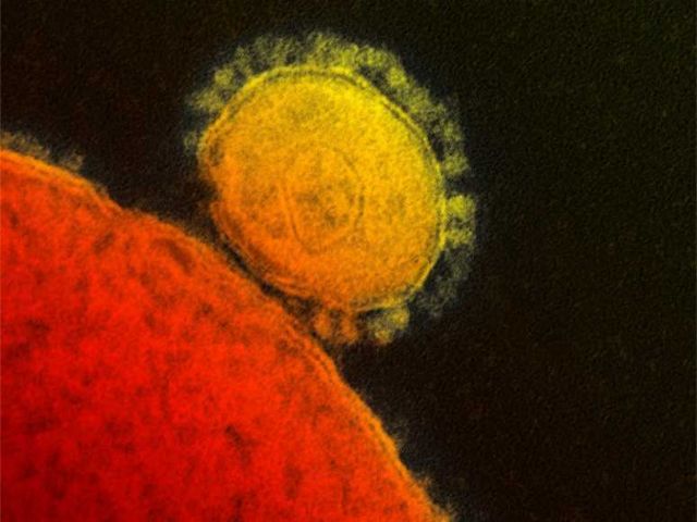 Στους 30 αυξήθηκαν οι νεκροί από το νέο κοροναϊό MERS