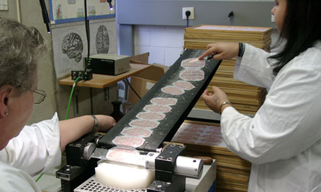 Ολοκληρώθηκε ο πληρέστερος ψηφιακός χάρτης του ανθρώπινου εγκεφάλου