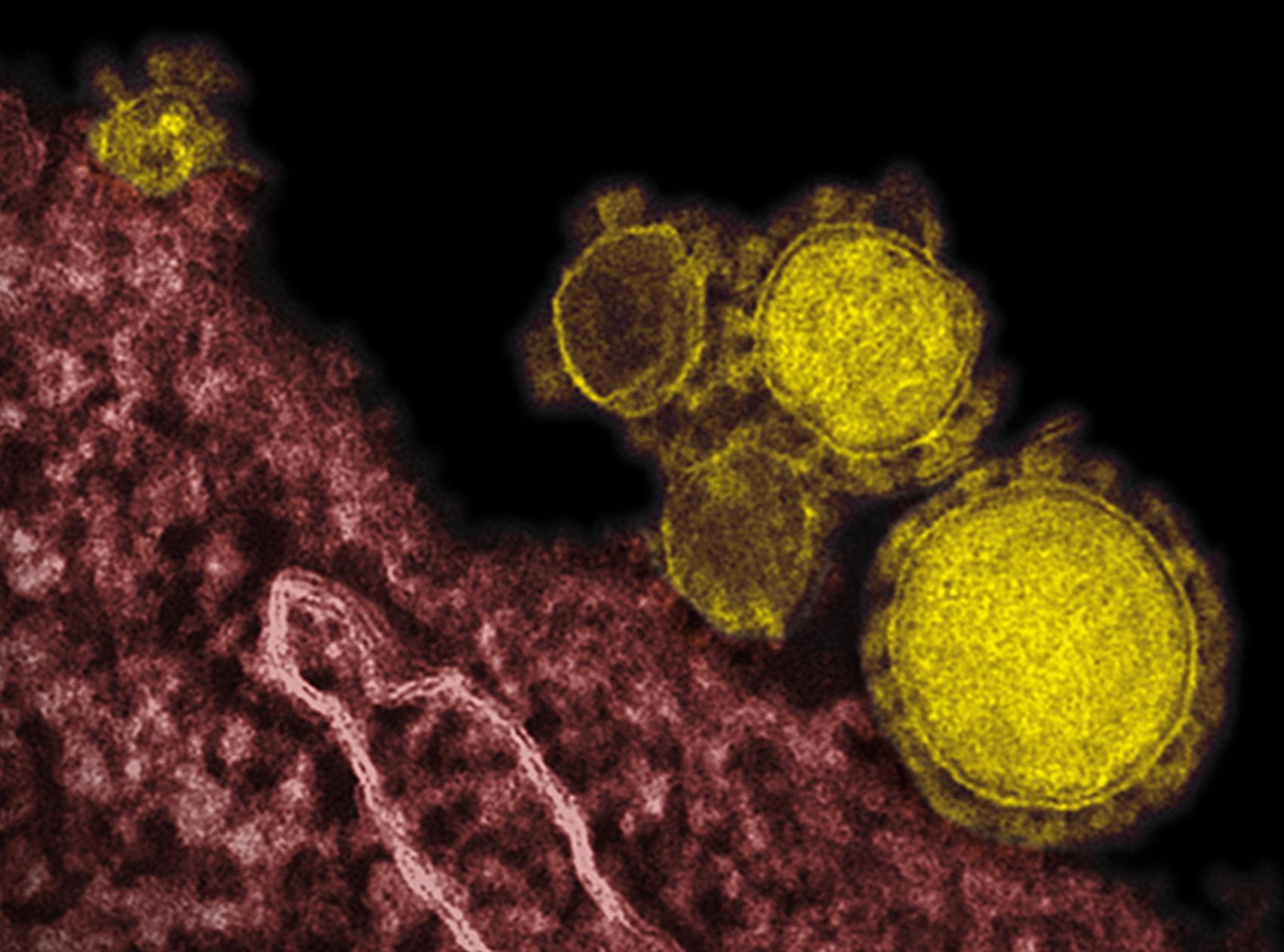 O ιός MERS δεν αποτελεί (ακόμα) παγκόσμια απειλή