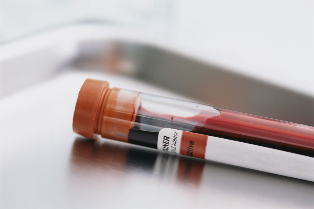 Κάντε έλεγχο ηπατίτιδας με μια απλή αιματολογική εξέταση