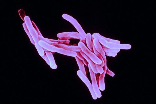 H φυματίωση κατέκτησε τον πλανήτη ακολουθώντας τo Homo sapiens