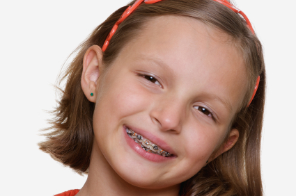 Σιδεράκια: Για όμορφο χαμόγελο και λειτουργική οδοντοστοιχία